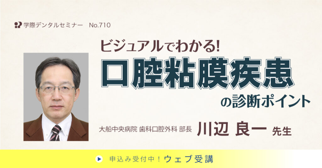 ビジュアルでわかる!口腔粘膜疾患の診断ポイント